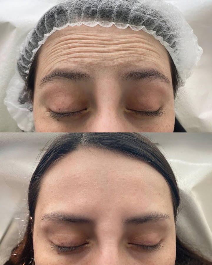 Laser One Clinic | Laser Hair Removal Business Bay Dubai — photo 5