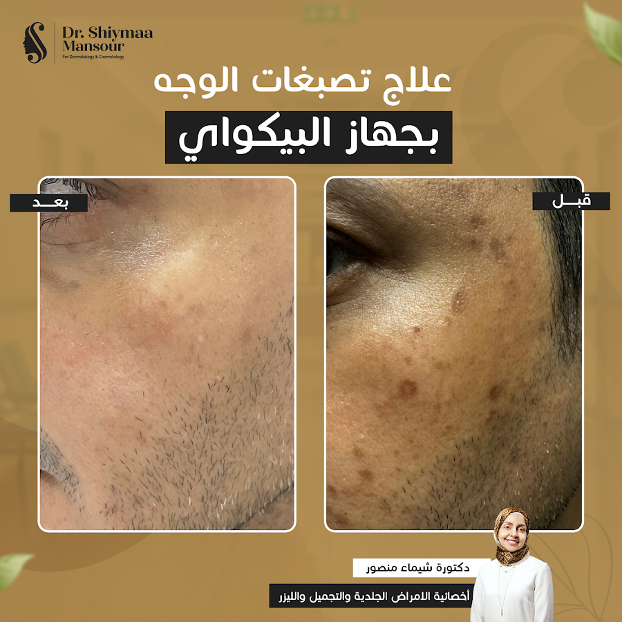 الدكتورة شيماء منصور | جلدية وتجميل وليزر بجدة — photo 5